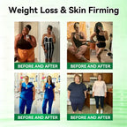 Microneedle Patch – Moringa & Berberine