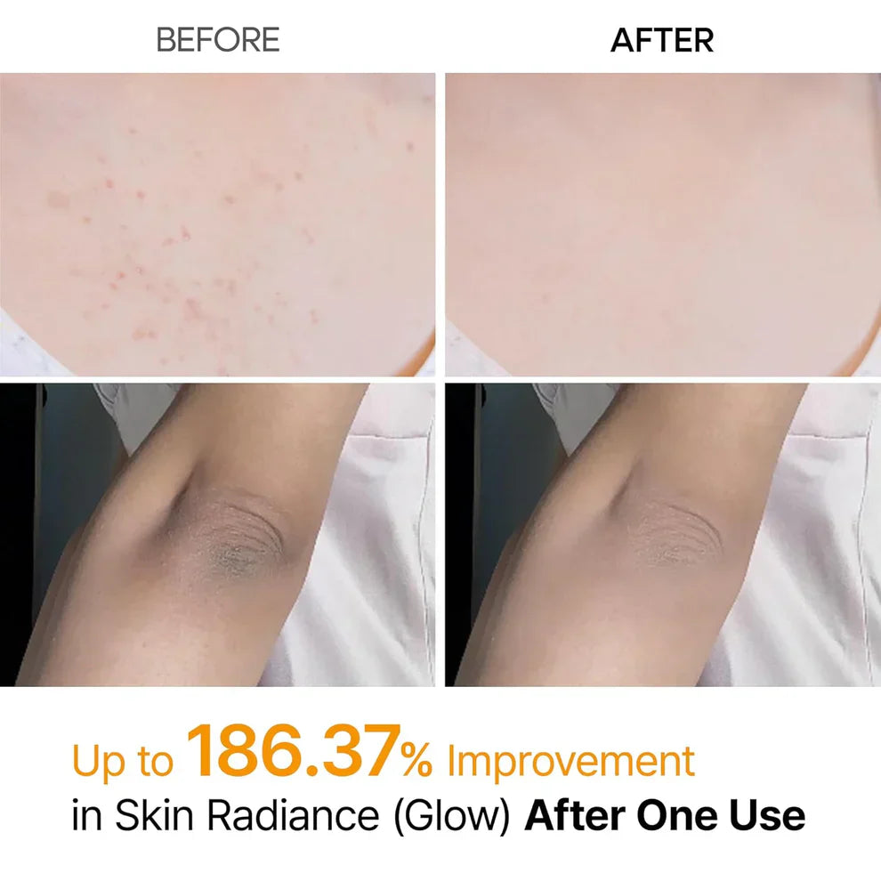 Body Peel Shot Spray – Smooth Skin Care