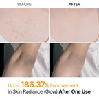 Body Peel Shot Spray – Smooth Skin Care