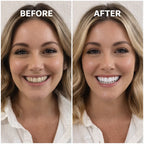 Purple Teeth Whitening Strips – PAP Formula
