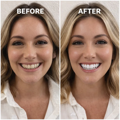PURPLE WHITENING STRIPS (Gen2)