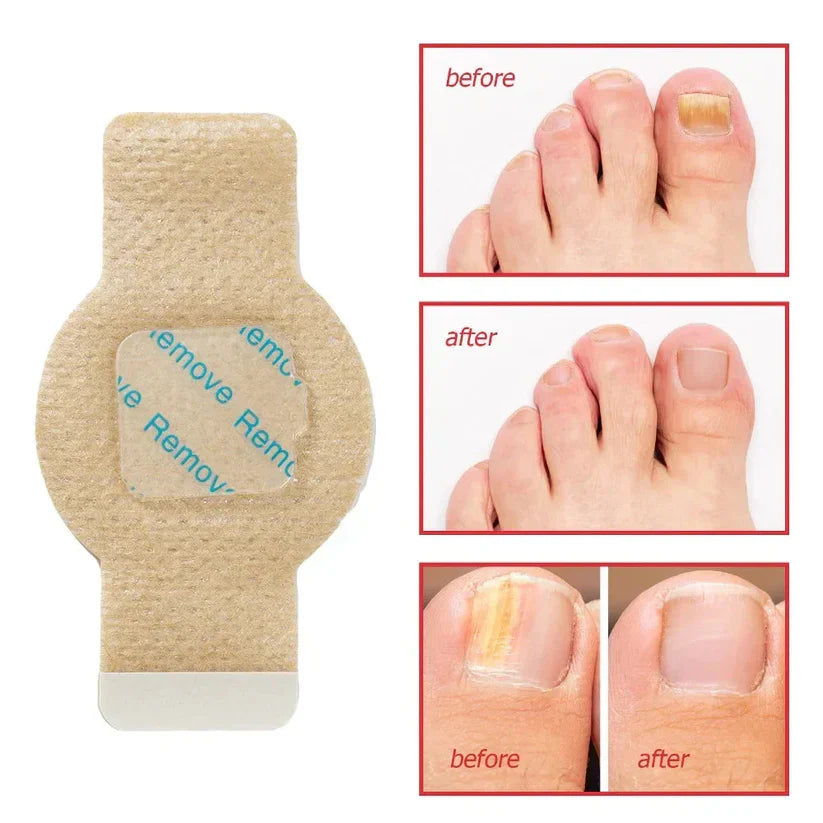 Nail Care Patches – Overnight Routine