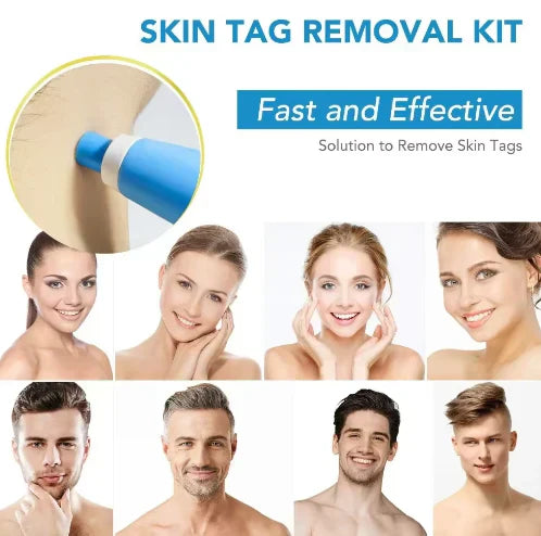 QunatroBay™ 2-in-1 Painless Skin Tag, Mole, and Wart Removal Kit