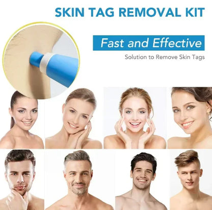 QunatroBay™ 2-in-1 Painless Skin Tag, Mole, and Wart Removal Kit