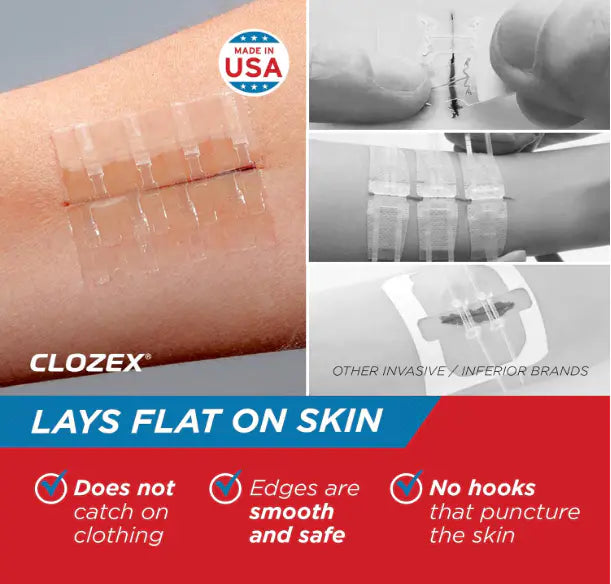 Emergency Wound Closure Strips – First Aid