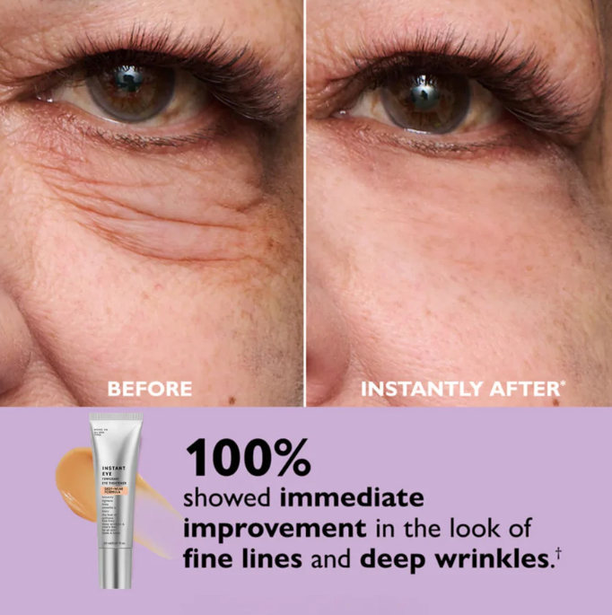 Instant Eye Tightener – Smoother Eye Area