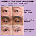 Instant Eye Tightener – Smoother Eye Area