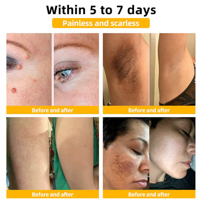QunatroBay™ Bee Venom Skin Treatment Cream