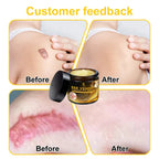 Bee Venom Skin Cream – Smooth & Nourish