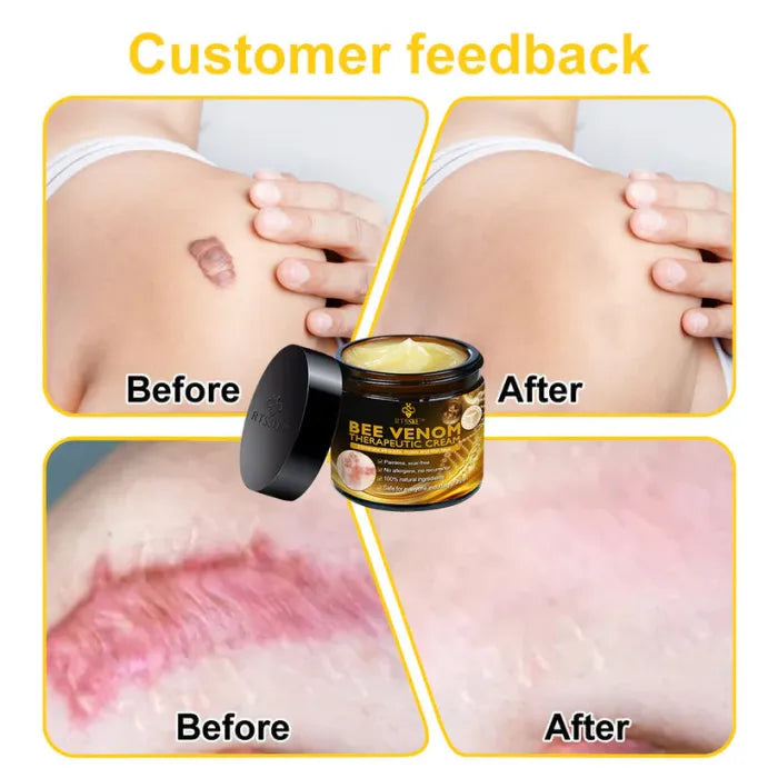QunatroBay™ Bee Venom Skin Treatment Cream