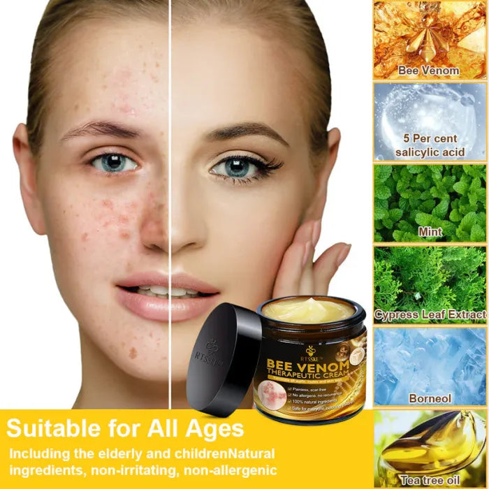 QunatroBay™ Bee Venom Skin Treatment Cream